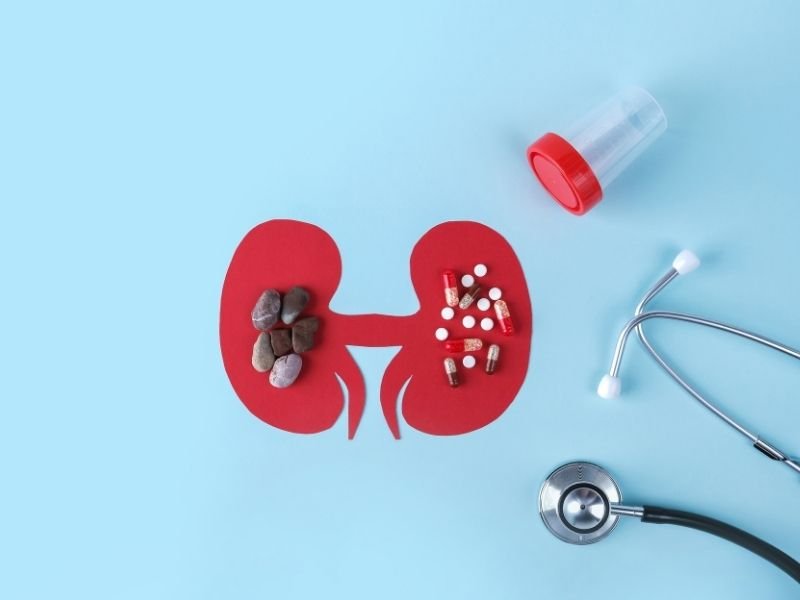 Cirurgia laparoscopica para pedra nos rins Curitiba