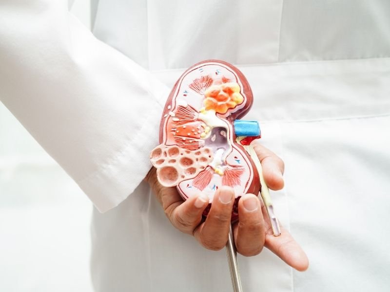 Cirurgiao de calculo renal Curitiba
