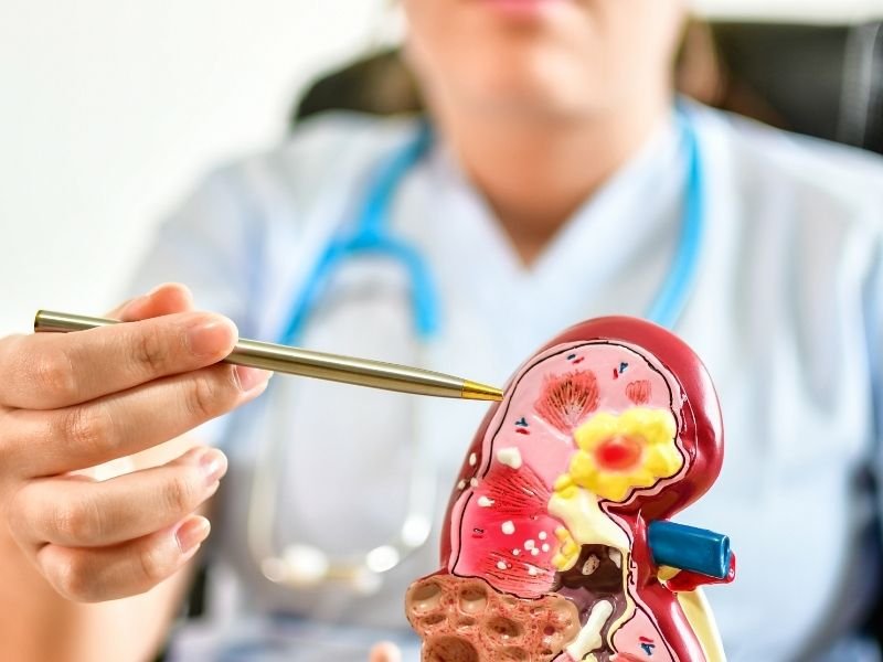 Cirurgiao urologico em Curitiba