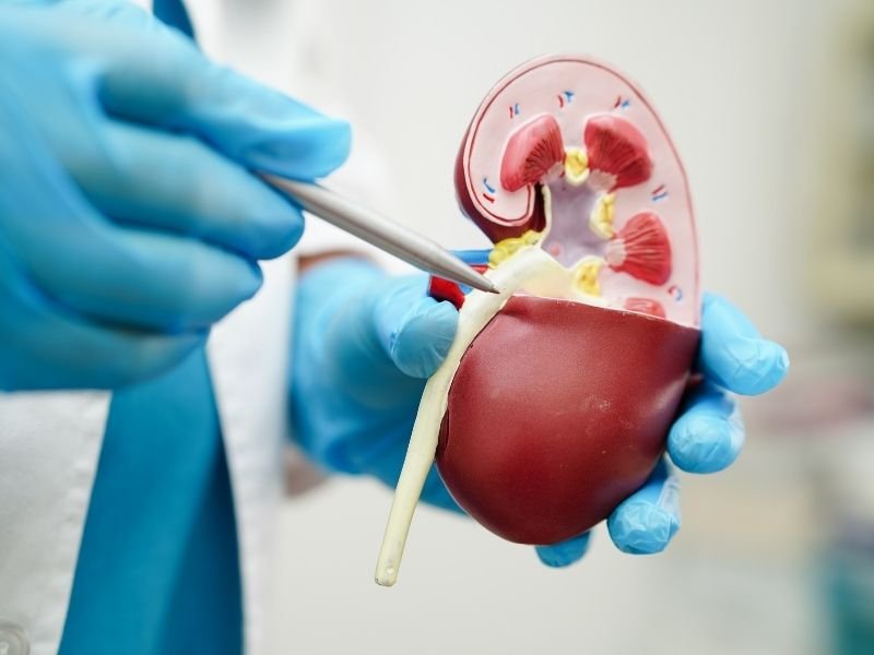 Tratamento cirurgico pedra nos rins Curitiba