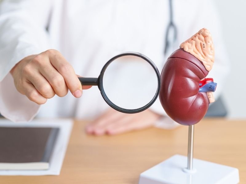 Tratamento especializado pedra nos rins Curitiba